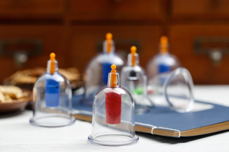 Hijama-Cupping